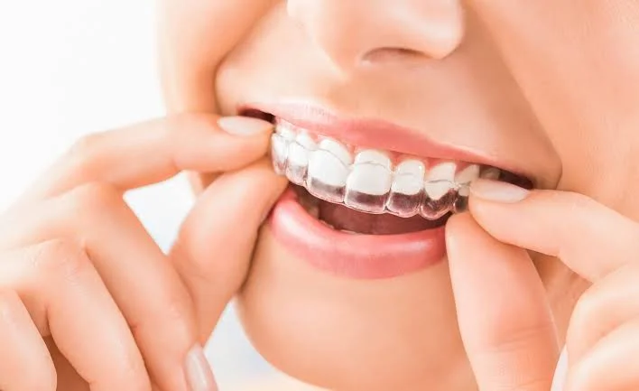 Paciente sorrindo com aparelho ortodôntico