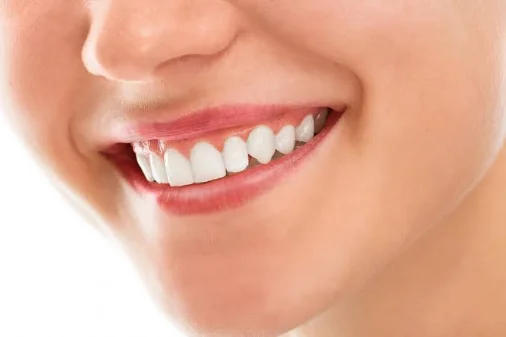 Close de um sorriso com dentes claros e alinhados