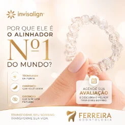 Publicação: por que o Invisalign é o alinhador número 1 do mundo